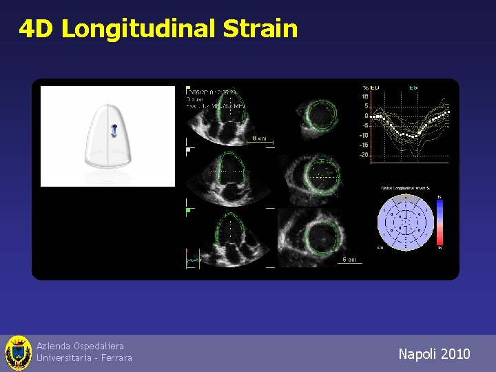 4 D Longitudinal Strain Azienda Ospedaliera Universitaria - Ferrara Napoli 2010 Trieste 