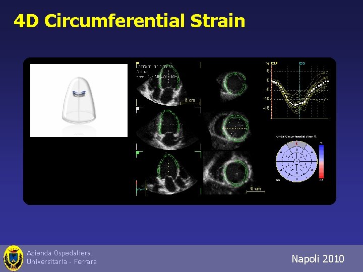 4 D Circumferential Strain Azienda Ospedaliera Universitaria - Ferrara Napoli 2010 Trieste 