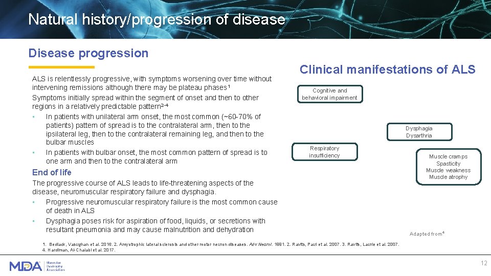 Natural history/progression of disease Disease progression ALS is relentlessly progressive, with symptoms worsening over