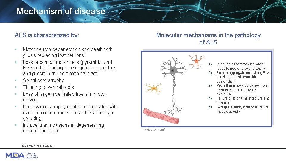 Mechanism of disease ALS is characterized by: • • Motor neuron degeneration and death