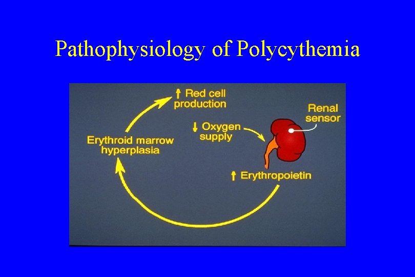 Pathophysiology of Polycythemia 