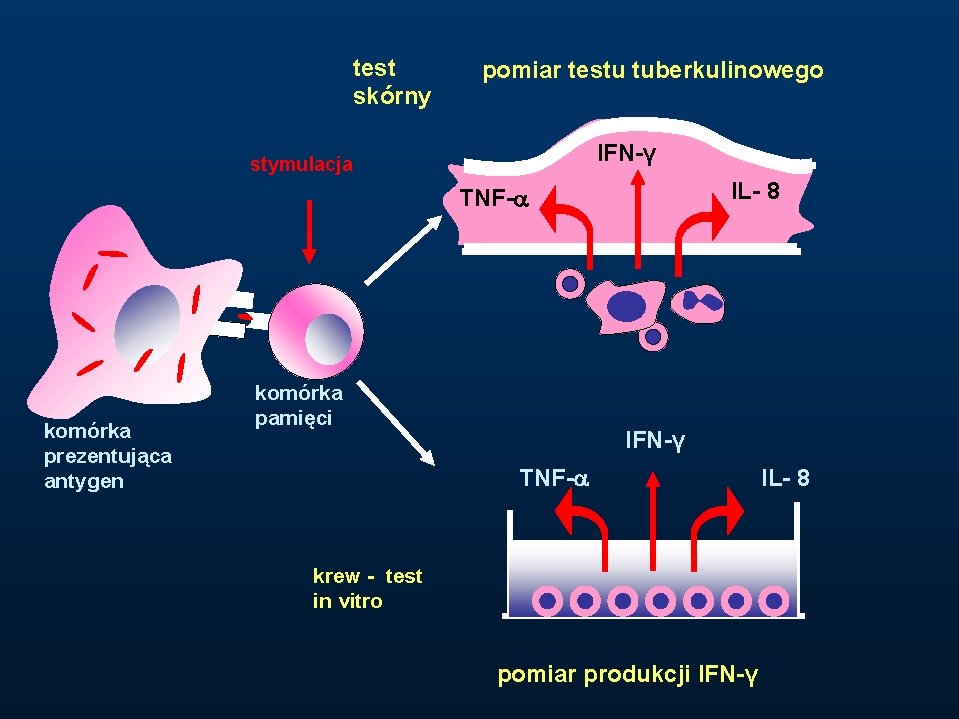 test skórny pomiar testu tuberkulinowego IFN-γ stymulacja IL- 8 TNF- komórka prezentująca antygen komórka
