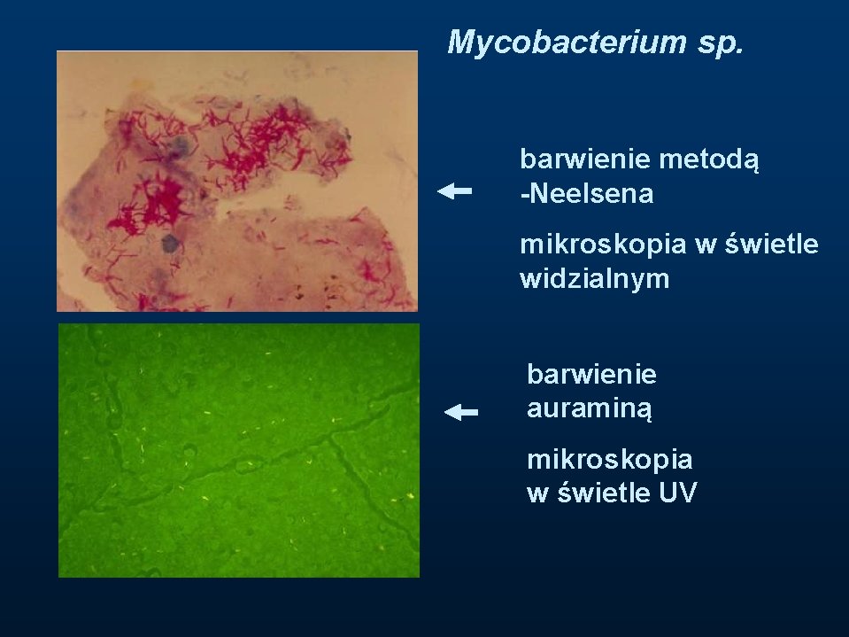 Mycobacterium sp. barwienie metodą -Neelsena mikroskopia w świetle widzialnym barwienie auraminą mikroskopia w świetle