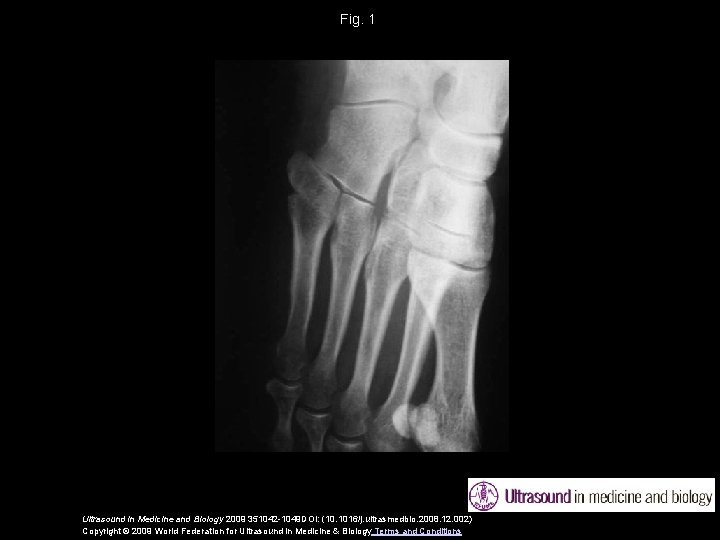 Fig. 1 Ultrasound in Medicine and Biology 2009 351042 -1049 DOI: (10. 1016/j. ultrasmedbio.