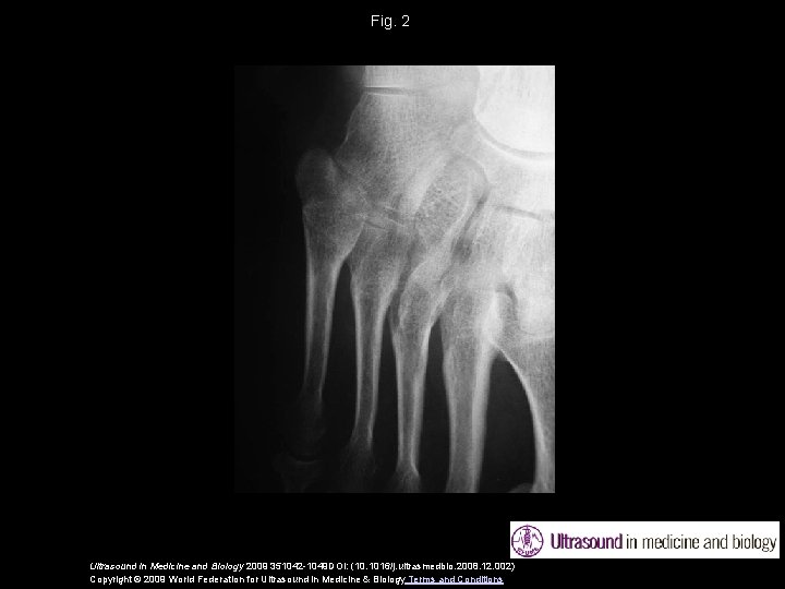 Fig. 2 Ultrasound in Medicine and Biology 2009 351042 -1049 DOI: (10. 1016/j. ultrasmedbio.