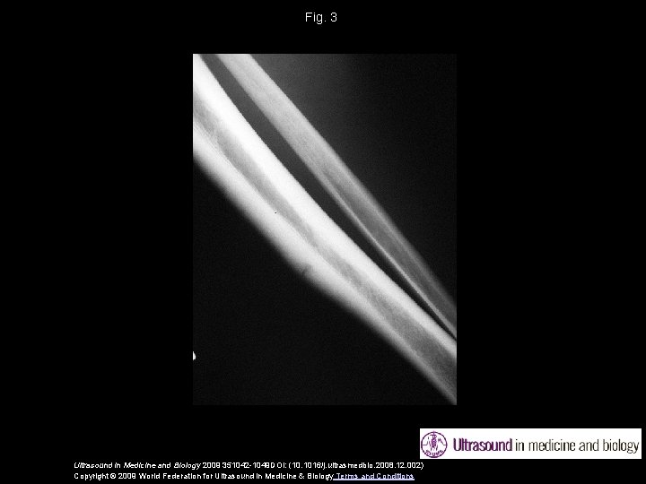 Fig. 3 Ultrasound in Medicine and Biology 2009 351042 -1049 DOI: (10. 1016/j. ultrasmedbio.
