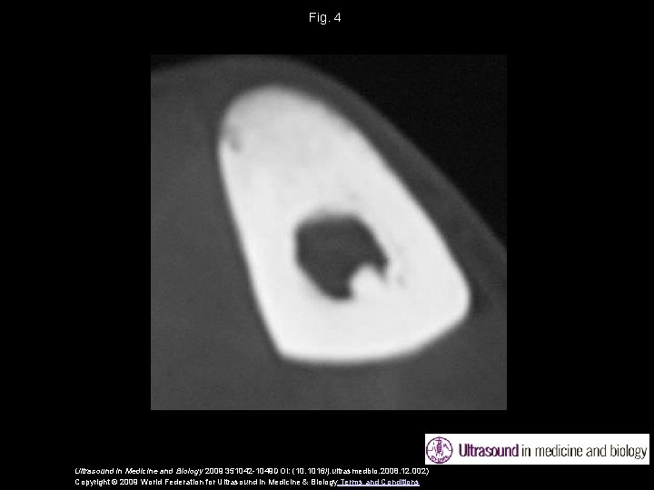 Fig. 4 Ultrasound in Medicine and Biology 2009 351042 -1049 DOI: (10. 1016/j. ultrasmedbio.