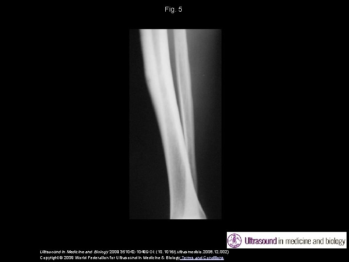Fig. 5 Ultrasound in Medicine and Biology 2009 351042 -1049 DOI: (10. 1016/j. ultrasmedbio.