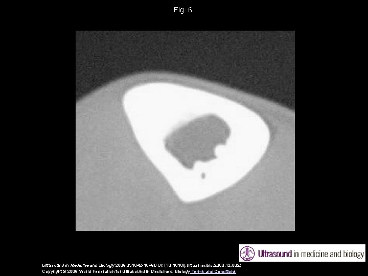 Fig. 6 Ultrasound in Medicine and Biology 2009 351042 -1049 DOI: (10. 1016/j. ultrasmedbio.