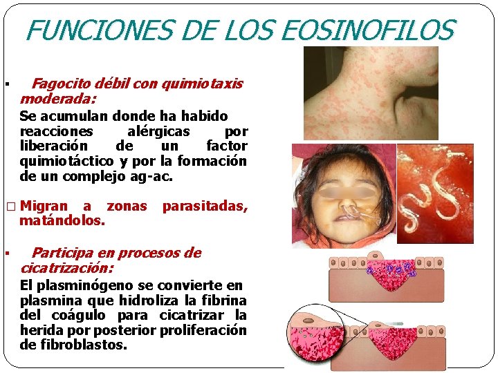 FUNCIONES DE LOS EOSINOFILOS § Fagocito débil con quimiotaxis moderada: Se acumulan donde ha