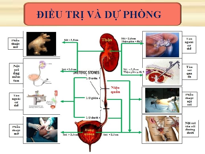 ĐIỀU TRỊ VÀ DỰ PHÒNG 