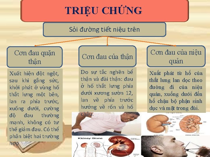 TRIỆU CHỨNG Sỏi đường tiết niệu trên Cơn đau quặn thận Xuất hiện đột