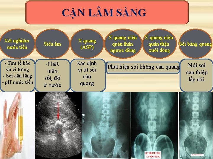 CẬN L M SÀNG Xét nghiệm nước tiểu Siêu âm X quang (ASP) - CẬN L M SÀNG Xét nghiệm nước tiểu Siêu âm X quang (ASP) -