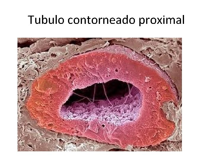 Tubulo contorneado proximal 