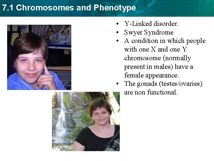 7. 1 Chromosomes and Phenotype • Y-Linked disorder. • Swyer Syndrome • A condition