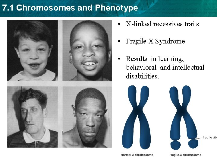 7. 1 Chromosomes and Phenotype • X-linked recessives traits • Fragile X Syndrome •