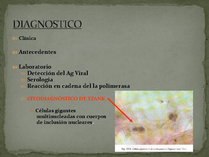 DIAGNOSTICO Clínica Antecedentes Laboratorio Detección del Ag Viral Serologia Reacción en cadena del la