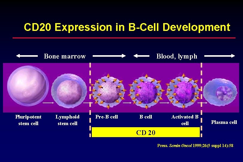 CD 20 Expression in B-Cell Development Bone marrow Pluripotent stem cell Lymphoid stem cell