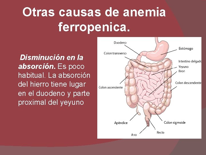 Otras causas de anemia ferropenica. Disminución en la absorción. Es poco habitual. La absorción