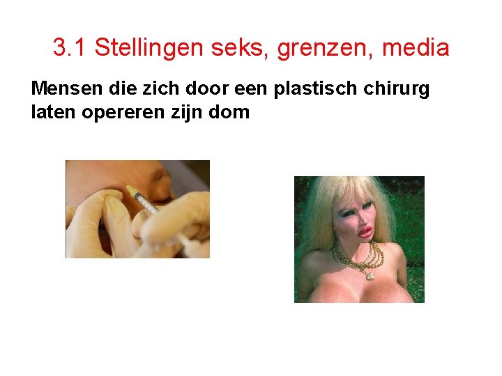 3. 1 Stellingen seks, grenzen, media Mensen die zich door een plastisch chirurg laten