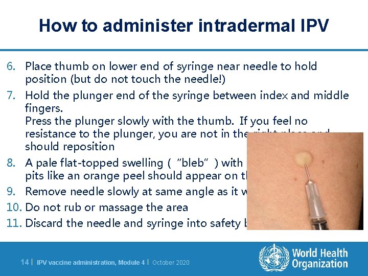 How to administer intradermal IPV 6. Place thumb on lower end of syringe near