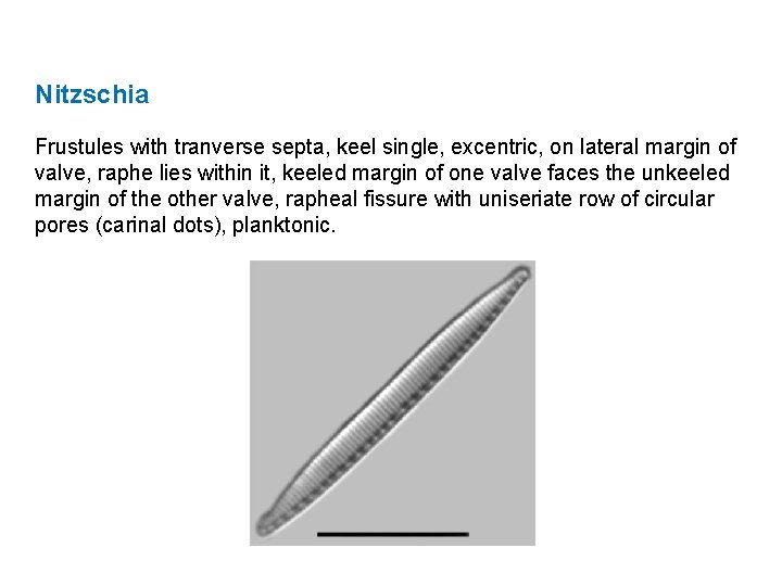 Nitzschia Frustules with tranverse septa, keel single, excentric, on lateral margin of valve, raphe