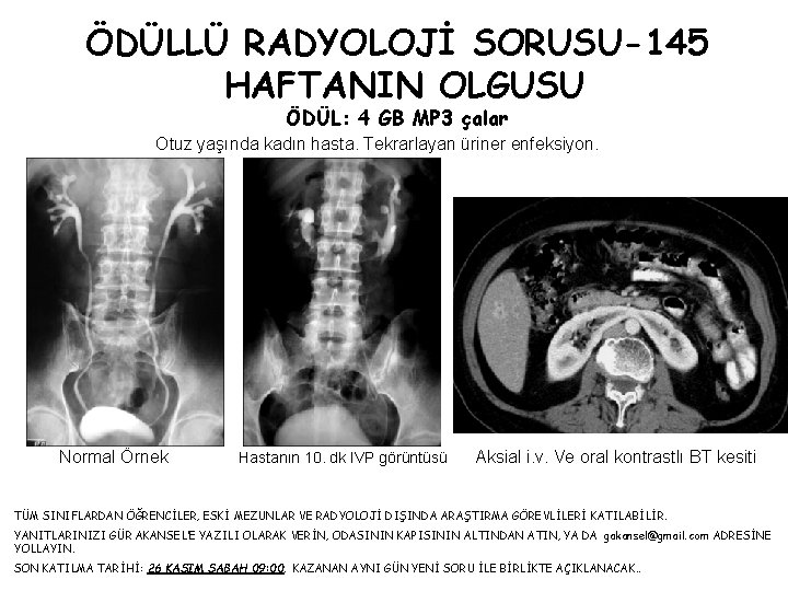 ÖDÜLLÜ RADYOLOJİ SORUSU-145 HAFTANIN OLGUSU ÖDÜL: 4 GB MP 3 çalar Otuz yaşında kadın