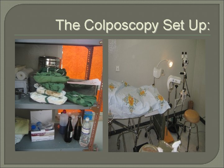 The Colposcopy Set Up: 