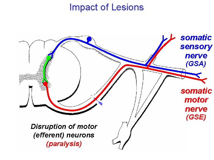 Impact of Lesions somatic sensory nerve (GSA) somatic motor nerve (GSE) Disruption of motor