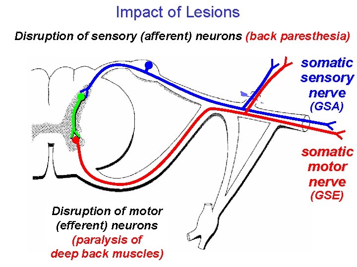 Impact of Lesions Disruption of sensory (afferent) neurons (back paresthesia) somatic sensory nerve (GSA)