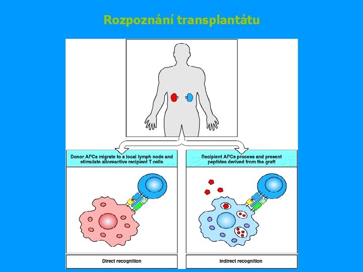 Rozpoznání transplantátu 