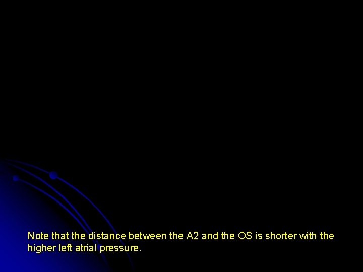 Note that the distance between the A 2 and the OS is shorter with