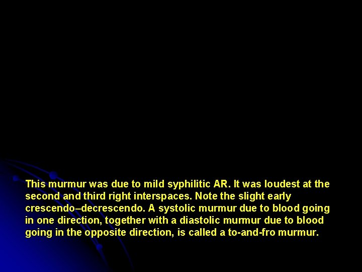 This murmur was due to mild syphilitic AR. It was loudest at the second