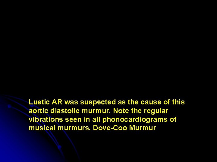 Luetic AR was suspected as the cause of this aortic diastolic murmur. Note the