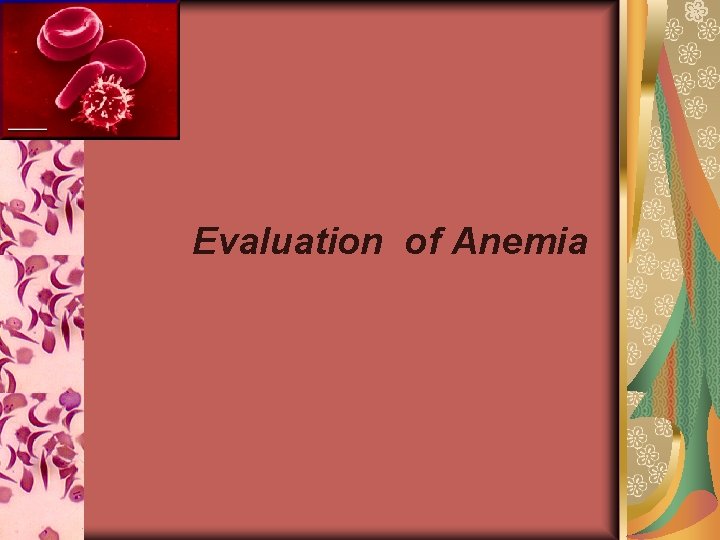 Evaluation of Anemia 