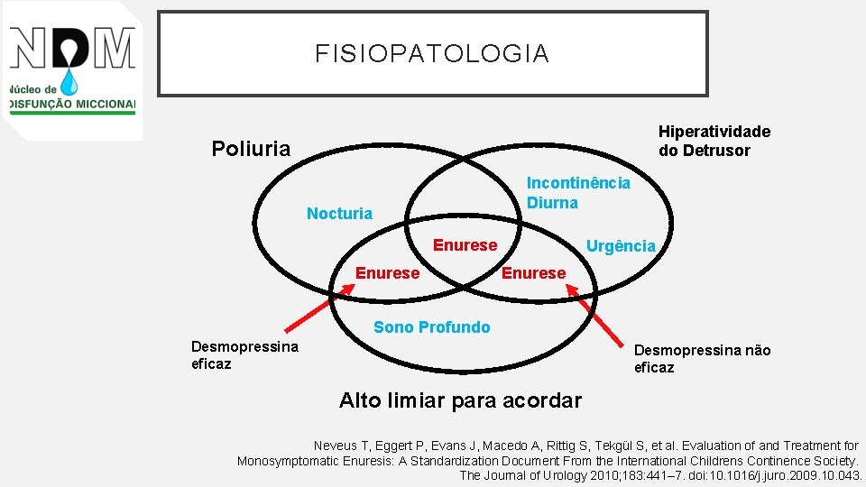 FISIOPATOLOGIA Hiperatividade do Detrusor Poliuria Incontinência Diurna Nocturia Enurese Urgência Enurese Sono Profundo Desmopressina