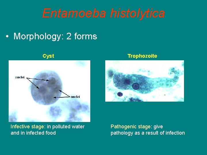 Entamoeba histolytica • Morphology: 2 forms Cyst Infective stage: in polluted water and in