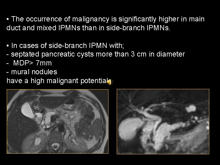 • The occurrence of malignancy is significantly higher in main duct and mixed • The occurrence of malignancy is significantly higher in main duct and mixed