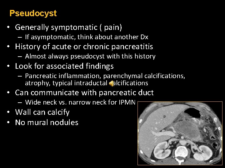 Pseudocyst • Generally symptomatic ( pain) – If asymptomatic, think about another Dx •