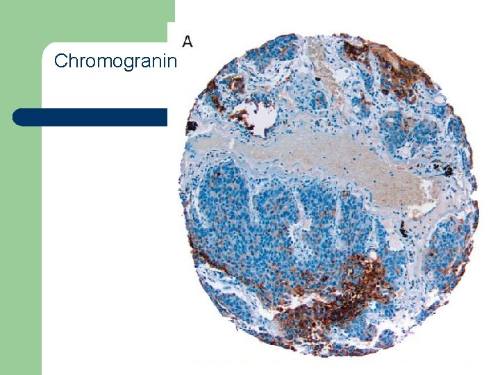 Chromogranin 