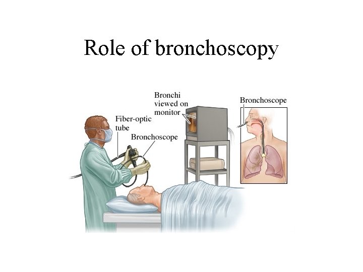 Role of bronchoscopy 