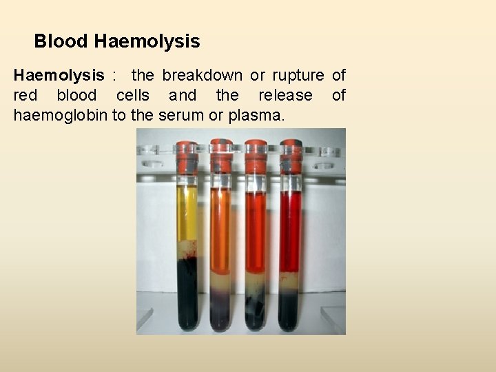 Blood Haemolysis : the breakdown or rupture of red blood cells and the release