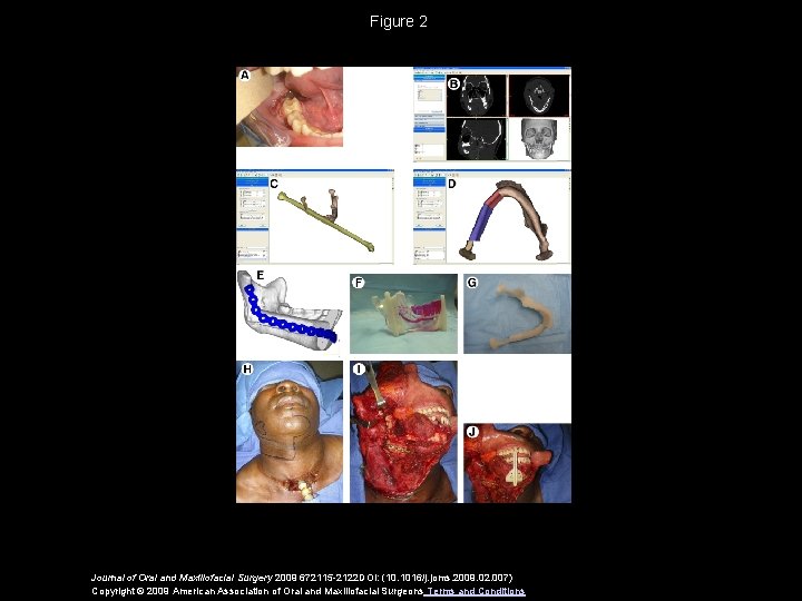 Figure 2 Journal of Oral and Maxillofacial Surgery 2009 672115 -2122 DOI: (10. 1016/j.