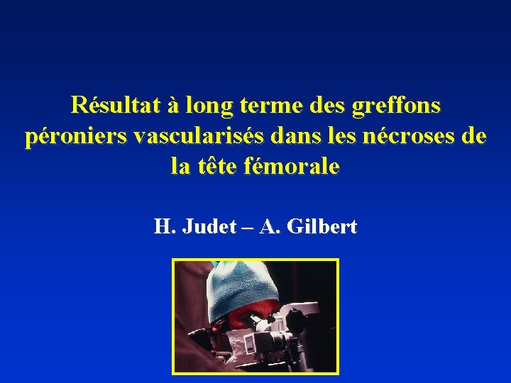 Résultat à long terme des greffons péroniers vascularisés dans les nécroses de la tête