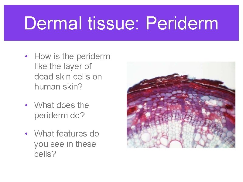 Dermal tissue: Periderm • How is the periderm like the layer of dead skin