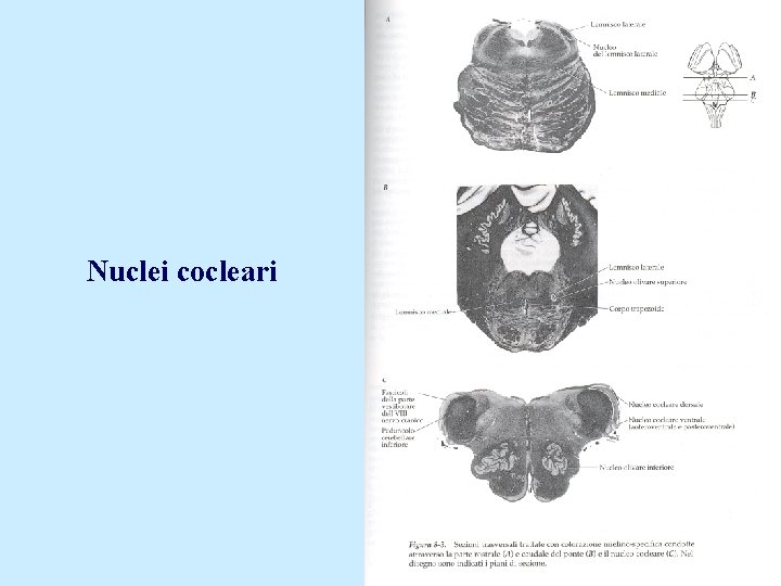 Nuclei cocleari 