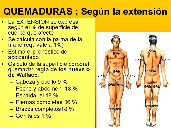 QUEMADURAS : Según la extensión • La EXTENSIÓN se expresa según el % de