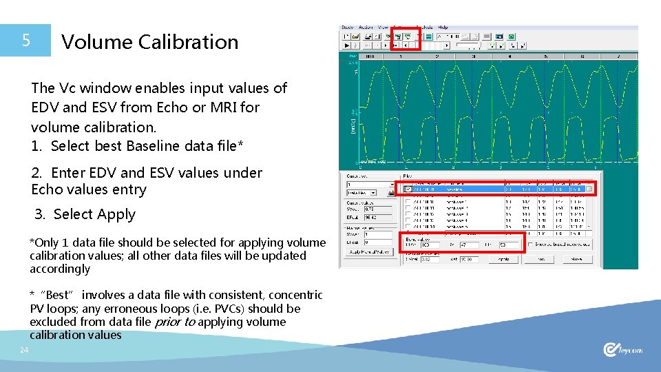 5 Volume Calibration The Vc window enables input values of EDV and ESV from