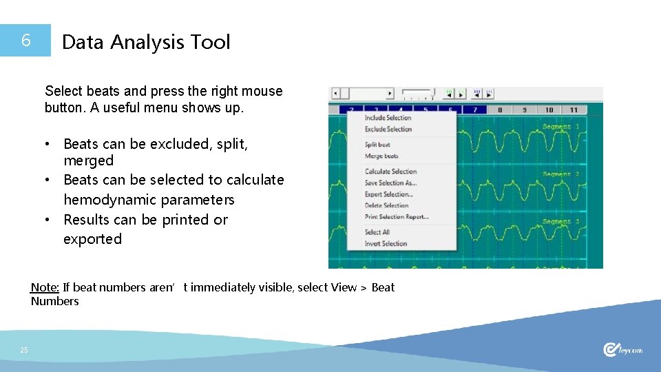 6 Data Analysis Tool Select beats and press the right mouse button. A useful