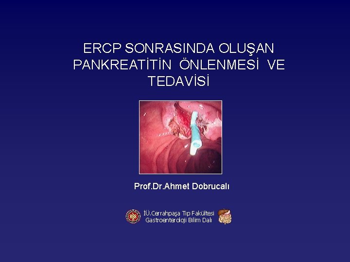 ERCP SONRASINDA OLUŞAN PANKREATİTİN ÖNLENMESİ VE TEDAVİSİ Prof. Dr. Ahmet Dobrucalı İÜ. Cerrahpaşa Tıp